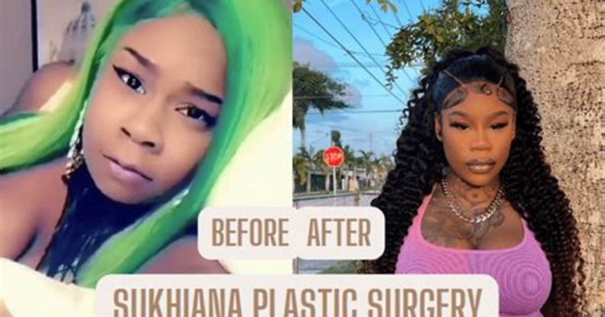 Sukihana Bbl Surgery | Before and After Photos