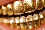 The Golden History of Golden Teeth and Grillz: Adding One More Reason to Smile