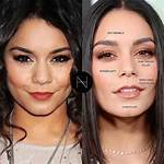 Vanessa Hudgens Botox | Before and After Photos 2023
