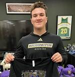 Washington Football Grady Gross Cleft Lip: What Is Wrong with His Face?