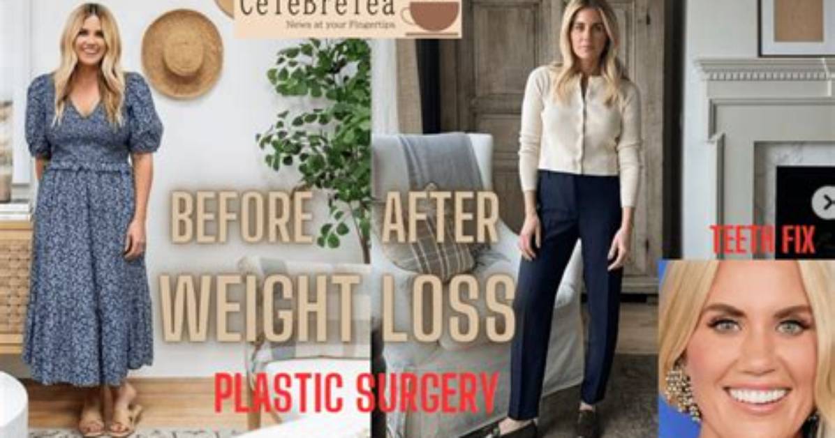 Weight Loss and Plastic Surgery