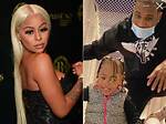 What Happened to Alexis Skyy's Daughter? Fans Have Plenty of Questions