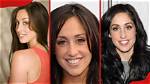 What Happened to Catherine Reitman's Lips? Botched Surgery Rumors