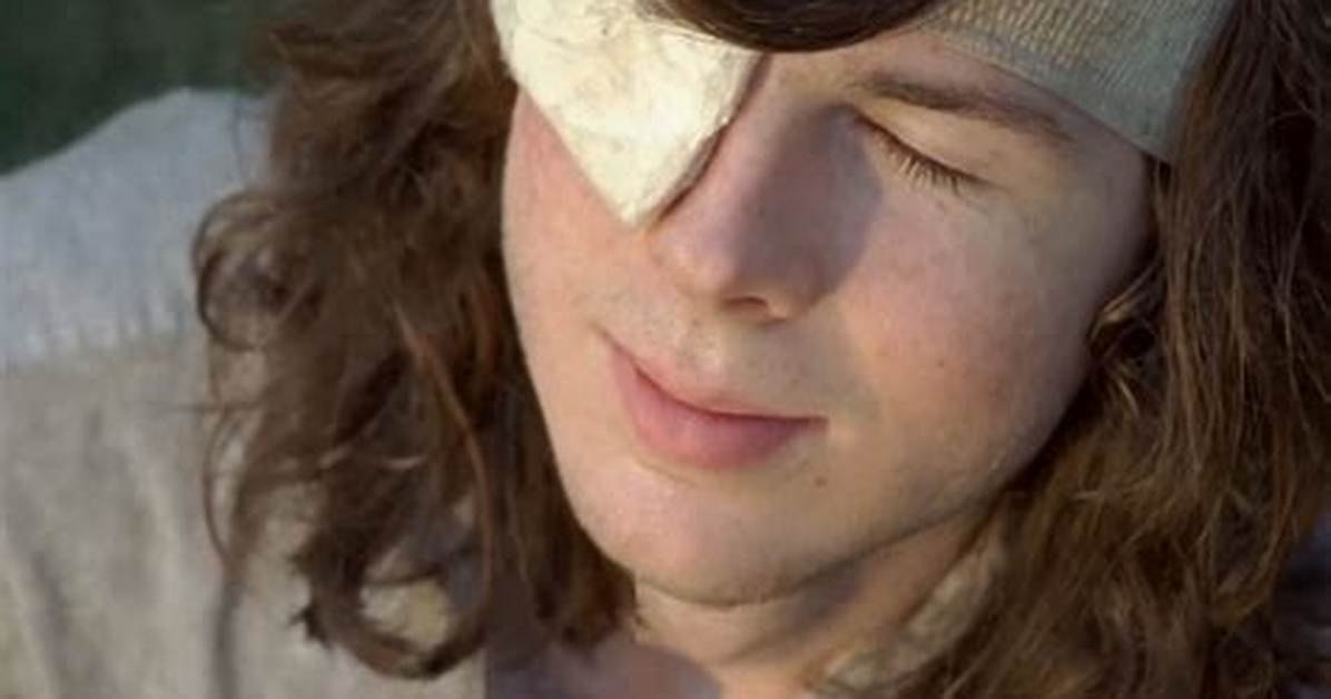What Happened to His Eye?