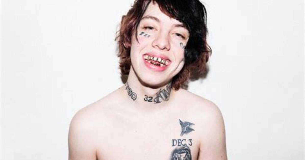 What Happened to Lil Xan Teeth | Before and After Photos