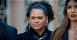 What Happened to Sandra's Forehead?