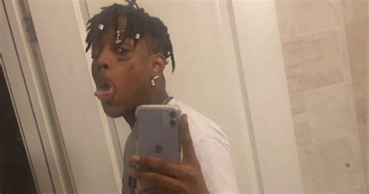 What Happened to Ski Mask the Slump God? He Showed off a Gruesome Injury on Instagram