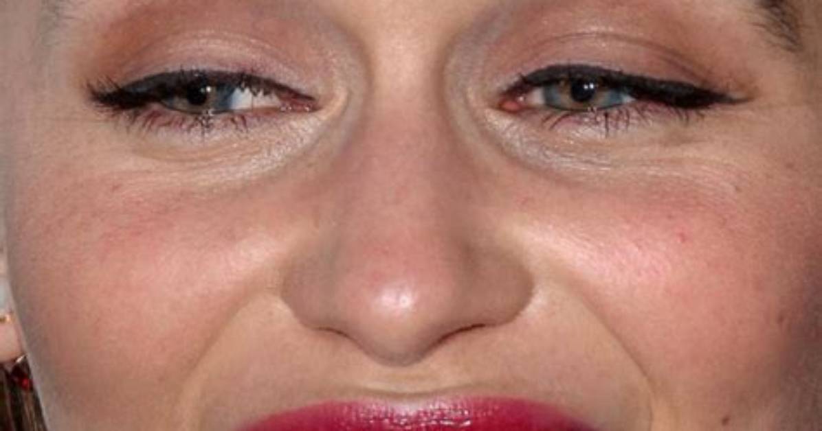 What Is Wrong with Emilia Clarke Teeth: Before and After