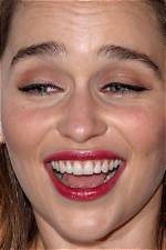 What Is Wrong with Emilia Clarke Teeth: Before and After
