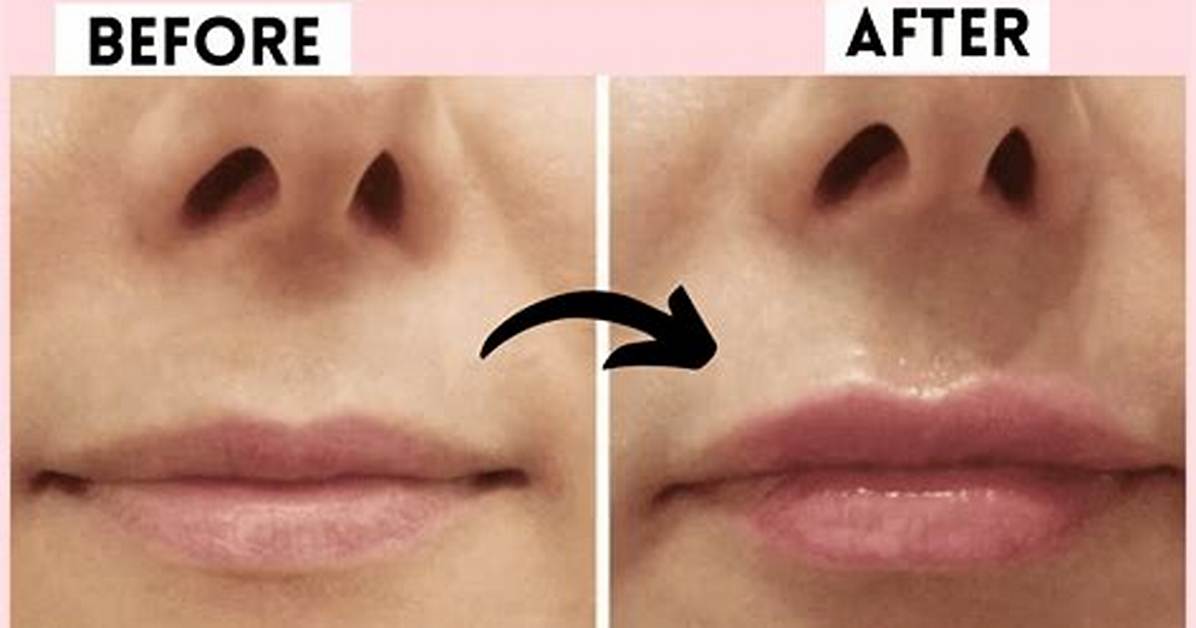 What Is Wrong with Her Lips?