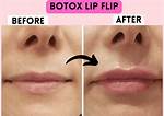 What Is Wrong with Her Lips?