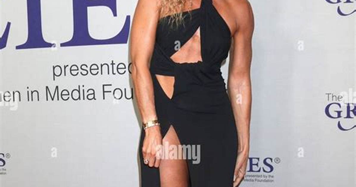 What Is Wrong with Kate Abdo Legs? Plastic Surgery Rumors