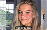 Who Is Nancy Morel? Wiki, Age, Height, Parents, Skin Condition, Net Worth, Boyfriend, Biography & More